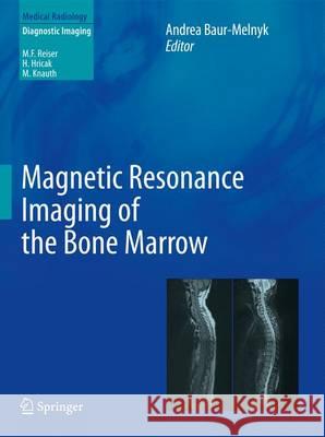 Magnetic Resonance Imaging of the Bone Marrow Andrea Baur-Melnyk 9783642178597 Springer