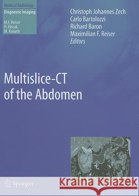 Multislice-CT of the Abdomen Christoph Johannes Zech Carlo Bartolozzi (University of Pisa, It Richard Baron 9783642178627