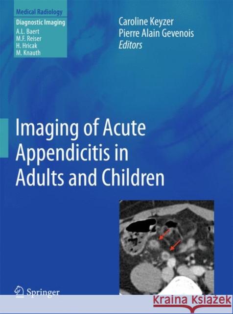Imaging of Acute Appendicitis in Adults and Children  9783642178719 Springer, Berlin