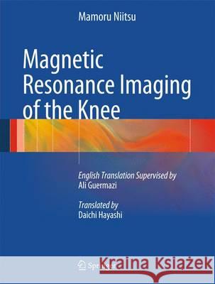 Magnetic Resonance Imaging of the Knee  Niitsu 9783642178924 Springer, Berlin