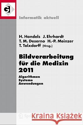 Bildverarbeitung Für Die Medizin 2011: Algorithmen - Systeme - Anwendungen Proceedings Des Workshops Vom 20. - 22. März 2011 in Lübeck Handels, Heinz 9783642193347