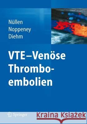 Vte - Venöse Thromboembolien Nüllen, Helmut 9783642214950 Springer, Berlin