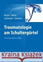 Traumatologie Am Schultergürtel: 54 Instruktive Fälle Meyer, Rainer-Peter 9783642218170