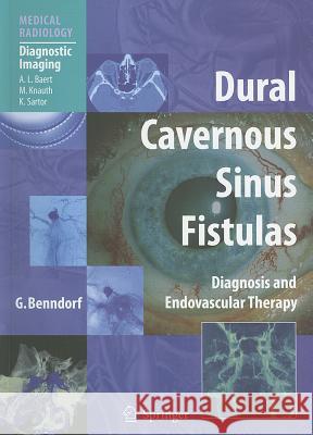 Dural Cavernous Sinus Fistulas: Diagnosis and Endovascular Therapy Benndorf, Goetz 9783642235979 Springer, Berlin