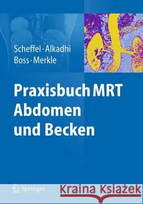 Praxisbuch Mrt Abdomen Und Becken Scheffel, Hans 9783642253393 Springer