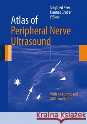 Atlas of Peripheral Nerve Ultrasound: With Anatomic and MRI Correlation Siegfried Peer, Hannes Gruber 9783642255939