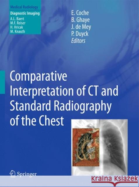 Comparative Interpretation of CT and Standard Radiography of the Chest Emmanuel E. Coche Benoit Ghaye Johan Mey 9783642265891