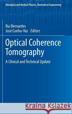 Optical Coherence Tomography: A Clinical and Technical Update Bernardes, Rui 9783642274091 Springer