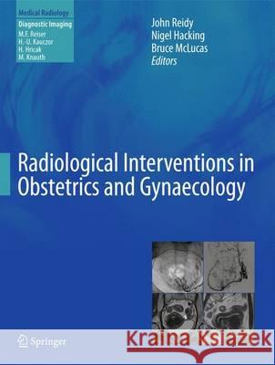 Radiological Interventions in Obstetrics and Gynaecology John Reidy Nigel Hacking Bruce McLucas 9783642279744 Springer