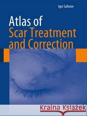 Atlas of Scar Treatment and Correction  Safonov 9783642291951 Springer, Berlin