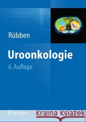 Uroonkologie  9783642350313 Springer, Berlin