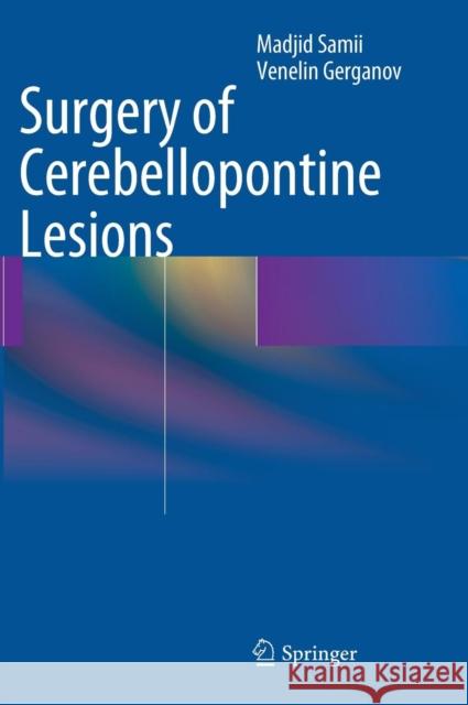 Surgery of Cerebellopontine Lesions Madjid Samii 9783642354212 Springer, Berlin