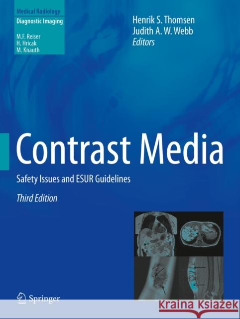 Contrast Media: Safety Issues and Esur Guidelines Thomsen, Henrik S. 9783642367236 Springer