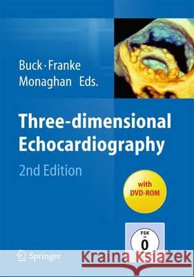 Three-Dimensional Echocardiography Buck, Thomas 9783642367984 Springer