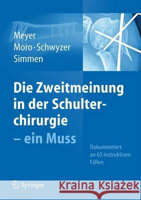 Die Zweitmeinung in Der Schulterchirurgie - Ein Muss Meyer, Rainer Peter 9783642370939