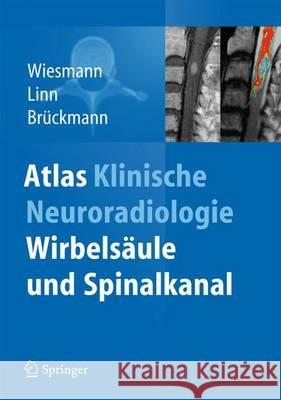 Atlas Klinische Neuroradiologie: Wirbelsäule Und Spinalkanal Wiesmann, Martin 9783642381089 Springer