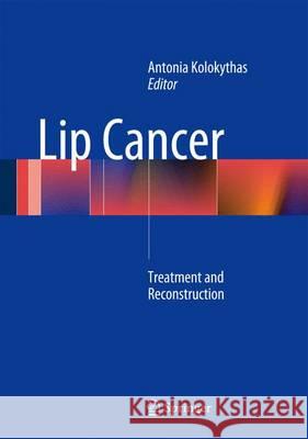 Lip Cancer: Treatment and Reconstruction Kolokythas, Antonia 9783642381799 Springer