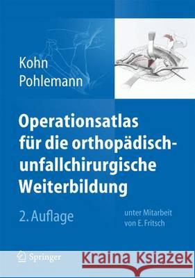 Operationsatlas Für Die Orthopädisch-Unfallchirurgische Weiterbildung Kohn, Dieter 9783642384202 Springer