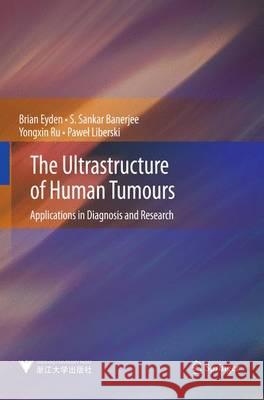 The Ultrastructure of Human Tumours: Applications in Diagnosis and Research Eyden, Brian 9783642391675 Springer