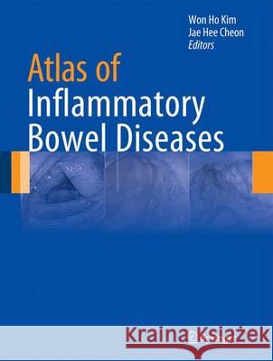 Atlas of Inflammatory Bowel Diseases Won Ho Kim Jae Hee Cheon 9783642394225 Springer