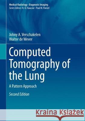 Computed Tomography of the Lung: A Pattern Approach Verschakelen, Johny A. 9783642395178 Springer
