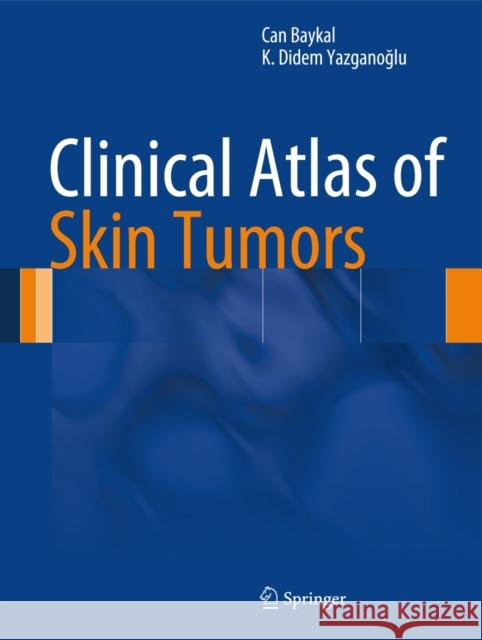 Clinical Atlas of Skin Tumors Can Baykal K. Didem Yazgan 9783642409370 Springer