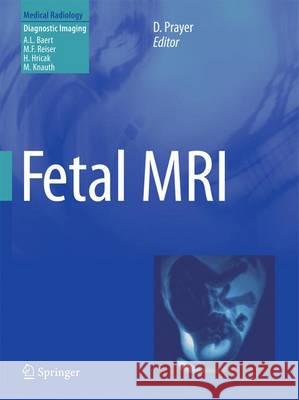 Fetal MRI Daniela Prayer Albert L. Baert 9783642422652 Springer