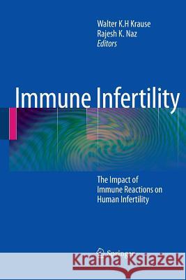 Immune Infertility: The Impact of Immune Reactions on Human Infertility Krause, Walter K. H. 9783642422867 Springer