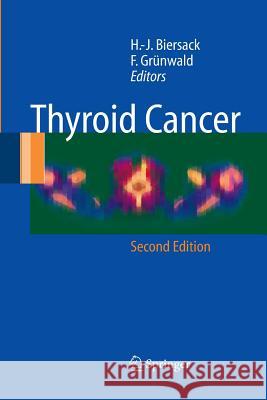 Thyroid Cancer H. -J Biersack F. Grunwald 9783642424137 Springer