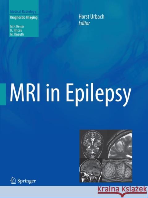 MRI in Epilepsy Horst Urbach 9783642438417 Springer