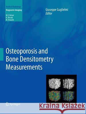 Osteoporosis and Bone Densitometry Measurements Giuseppe Guglielmi 9783642438837 Springer