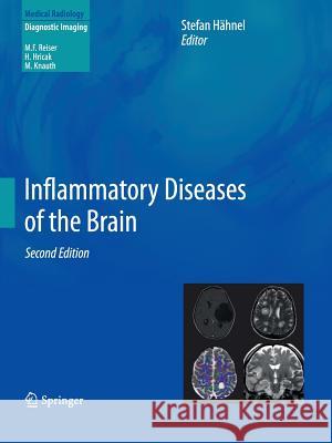 Inflammatory Diseases of the Brain Stefan Hahnel 9783642440847 Springer