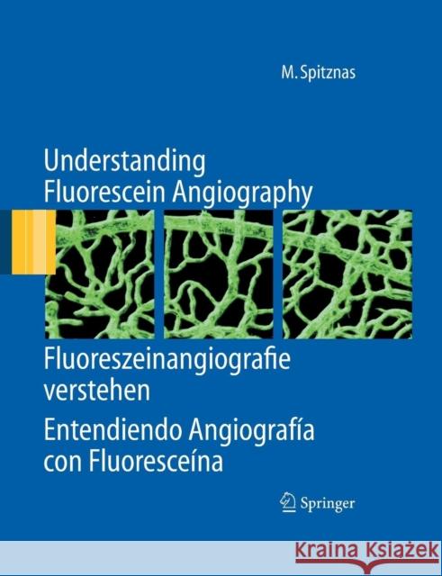 Understanding Fluorescein Angiography, Fluoreszeinangiografie Verstehen, Entendiendo Angiografía Con Fluoresceína Quiroz-Mercado, H. 9783642440854