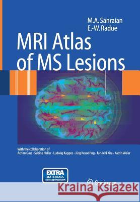 MRI Atlas of MS Lesions M. a. Sahraian Ernst-Wilhelm Radu 9783642447815 Springer