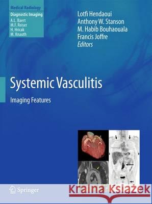 Systemic Vasculitis: Imaging Features Hendaoui, Lotfi 9783642448485 Springer