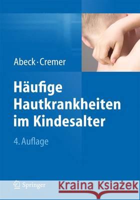 Häufige Hautkrankheiten Im Kindesalter: Klinik - Diagnose - Therapie Abeck, Dietrich 9783642449796
