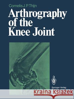 Arthrography of the Knee Joint C. J. P. Thijn J. R. Blickman 9783642464003 Springer