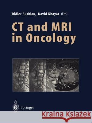 CT and MRI in Oncology Didier Buthiau David Khayat S. Buthiau 9783642468445