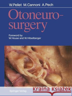 Otoneurosurgery William Pellet Maurice Cannoni Andre Pech 9783642486944 Springer