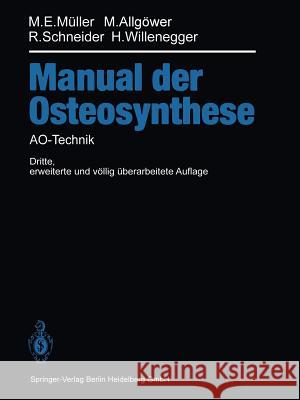 Manual Der Osteosynthese: Ao-Technik Perren, S. M. 9783642491405