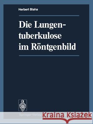 Die Lungentuberkulose Im Röntgenbild Blaha, H. 9783642491801 Springer