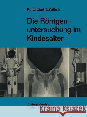 Die Röntgenuntersuchung Im Kindesalter: Technik Und Indikation Ebel, Klaus-Dietrich 9783642494048 Springer