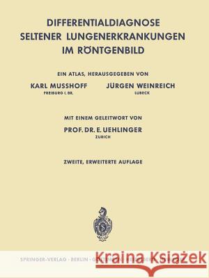 Differentialdiagnose Seltener Lungenerkrankungen Im Röntgenbild: Ein Atlas Musshoff, Karl 9783642494444 Springer