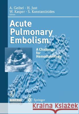 Acute Pulmonary Embolism: A Challenge for Hemostasiology Geibel, A. 9783642511929 Steinkopff-Verlag Darmstadt