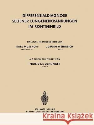 Differentialdiagnose Seltener Lungenerkrankungen Im Röntgenbild Musshoff, Karl 9783642530593 Springer