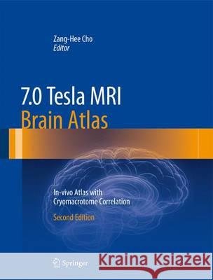 7.0 Tesla MRI Brain Atlas: In-Vivo Atlas with Cryomacrotome Correlation Cho, Zang-Hee 9783642543975 Springer