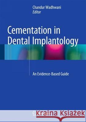 Cementation in Dental Implantology: An Evidence-Based Guide Wadhwani, Chandur P. K. 9783642551628