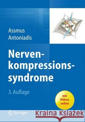 Nervenkompressionssyndrome Assmus, Hans 9783642552113