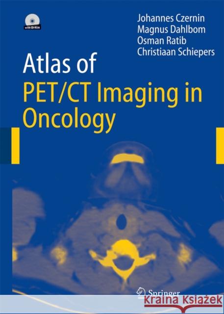 Atlas of Pet/CT Imaging in Oncology Czernin, Johannes 9783642621413 Springer