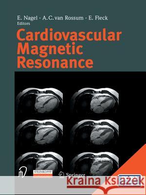 Cardiovascular Magnetic Resonance E. Nagel A. C. Van Rossum E. Fleck 9783642621529 Steinkopff-Verlag Darmstadt